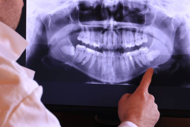 Best Emergency Root Canal Treatment in De Soto, MO